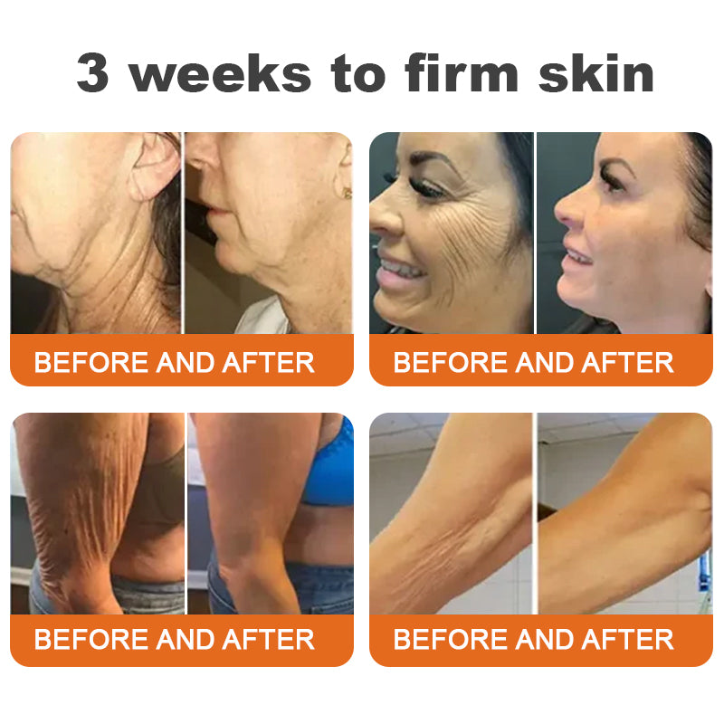 ✨Flysmus™ Botox Bee Venom Firming Serum Stick🔥ÚLTIMO DIA 70% DE DESCONTO