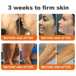 ✨Flysmus™ Botox Bee Venom Firming Serum Stick🔥ÚLTIMO DIA 70% DE DESCONTO
