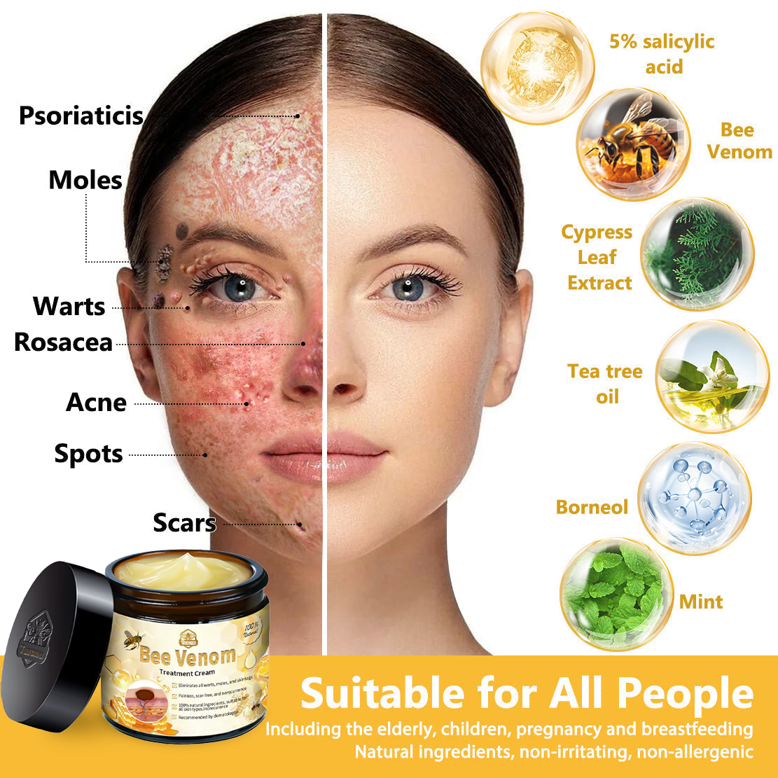 BSWELL™ Bee Venom Creme de tratamento para pele. PROMOÇÃO  - 4 Potes (Compre 2 Leve 4 )