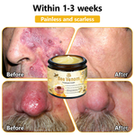BSWELL™ Bee Venom Creme de tratamento para pele. PROMOÇÃO  - 4 Potes (Compre 2 Leve 4 )