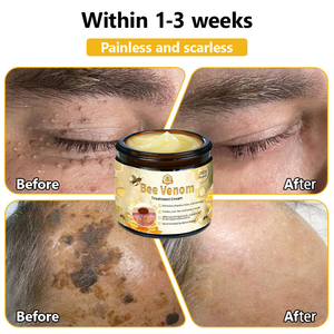 BSWELL™ Bee Venom Creme de tratamento para pele. PROMOÇÃO  - 4 Potes (Compre 2 Leve 4 )