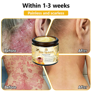 BSWELL™ Bee Venom Creme de tratamento para pele. PROMOÇÃO  - 4 Potes (Compre 2 Leve 4 )