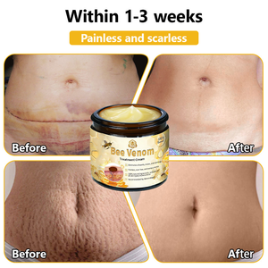 BSWELL™ Bee Venom Creme de tratamento para pele. PROMOÇÃO  - 4 Potes (Compre 2 Leve 4 )