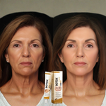 Creme Rejuvenescedor Apiluxe™ com Veneno de Abelha