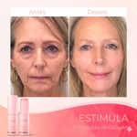 Creme Rejuvenescedor Anti-Age - Anti Manchas & Expressões™ OFERTA ÚLTIMO DIA 🎁  (COMPRE 1 LEVE 3)