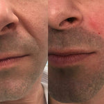 Serum Retinol PRO Coreano - Rejuvenescedor