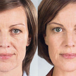 BotoxLux™ Creme Lifting com Peptídeos