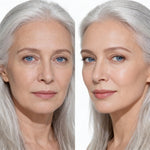 Base FitViya® 3 em 1