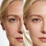 Collagen Skin Botox™ - Colágeno + Ácido Hialurônico