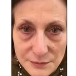 Serum Retinol PRO Coreano - Rejuvenescedor