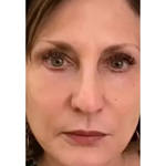 Serum Retinol PRO Coreano - Rejuvenescedor