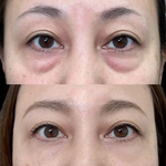 Serum Retinol PRO Coreano - Rejuvenescedor