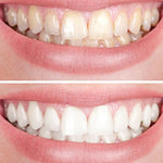 Clareador Dental Viya White  - PROMOÇÃO COMPRE 1 LEVE 2  (50% DE DESCONTO)
