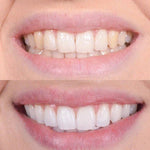 Clareador Dental Viya White  - PROMOÇÃO COMPRE 1 LEVE 2  (50% DE DESCONTO)
