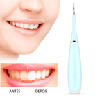 Escova Elétrica Branqueadora Dental Pro