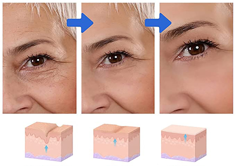 Vision™ 3D - Revitaliza os Olhos 6 Em 1