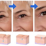 Vision™ 3D - Revitaliza os Olhos 6 Em 1
