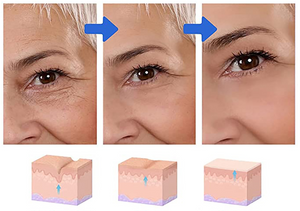 Vision™ 3D - Revitaliza os Olhos 6 Em 1