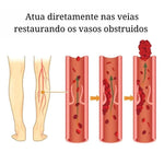 Adesivo removedor de Varizes – Varicose Veins