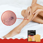Adesivo removedor de Varizes – Varicose Veins