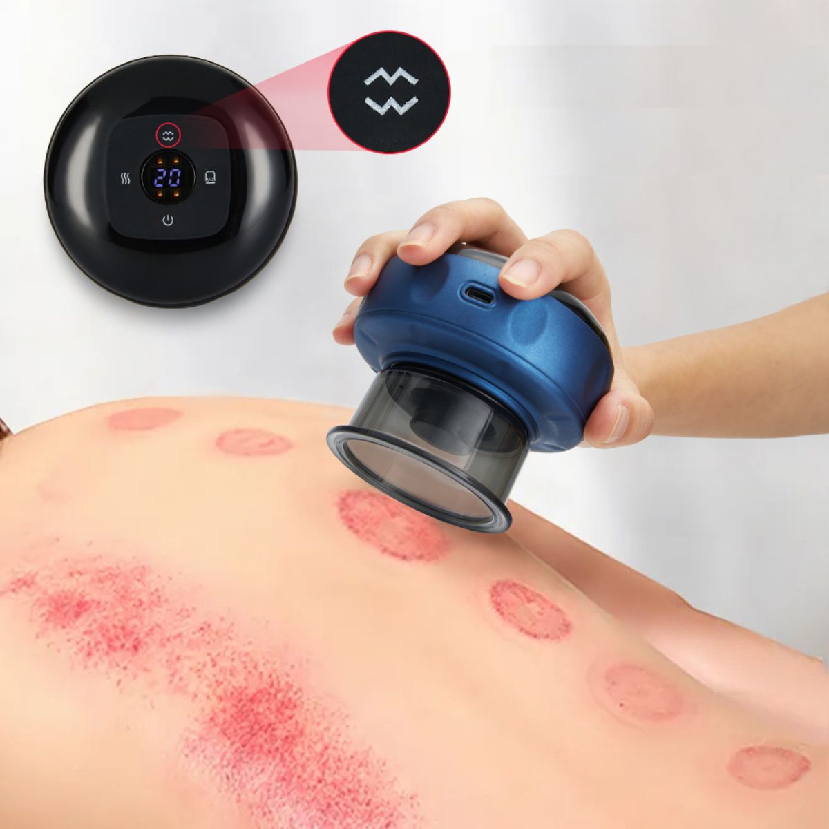 Aparelho de Ventosaterapia Elétrico – Massagem Detox