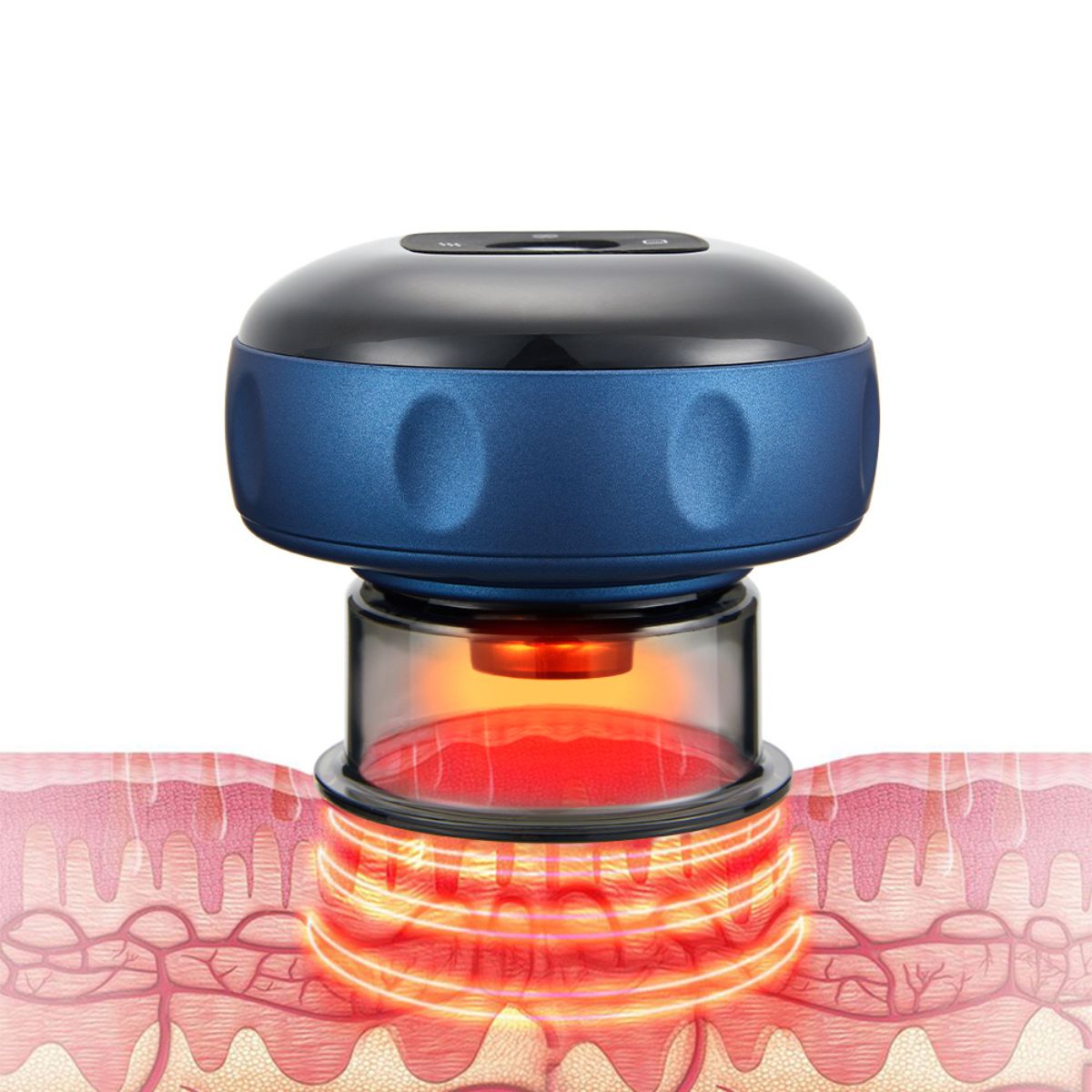 Aparelho de Ventosaterapia Elétrico – Massagem Detox