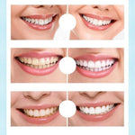 Clareador Dental Sorriso Max