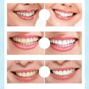 Clareador Dental Sorriso Max