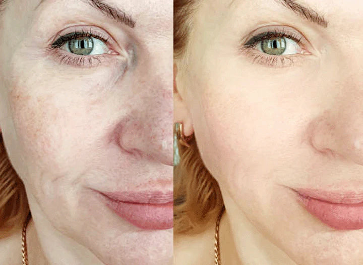 Turmeric Sérum® - Corretor de Manchas Escuras e Melasma PROMOÇÃO (50% DE DESCONTO)