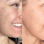Turmeric Sérum® - Corretor de Manchas Escuras e Melasma PROMOÇÃO (50% DE DESCONTO)